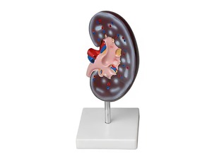 Модель почки в разрезе - fgospostavki.ru - Красный Сулин